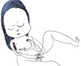 Fig 5